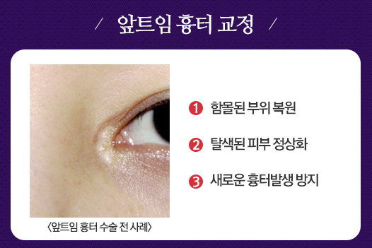 언론보도 이미지