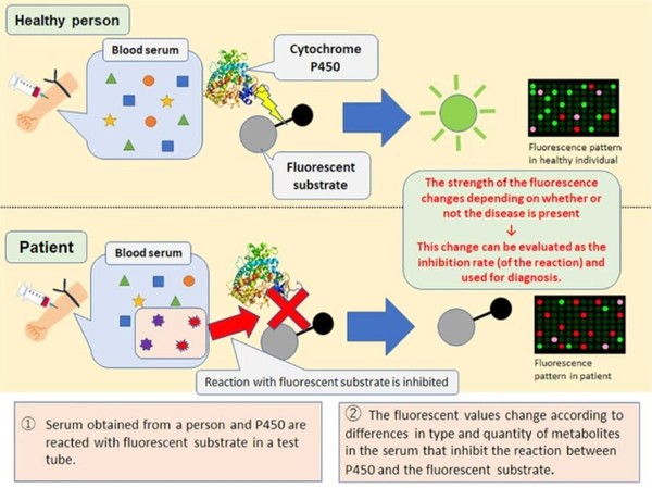 파킨슨병을 조기 진단하는 바이오마커 해설 그림. 이미지=포브스