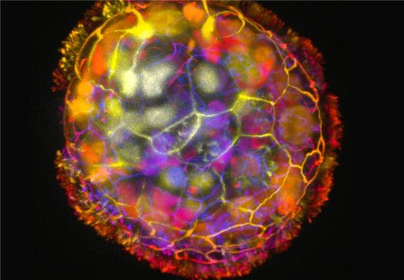 인간 세포로 만들어진 치료용 초소형 앤트로봇. 사진=터프츠대학