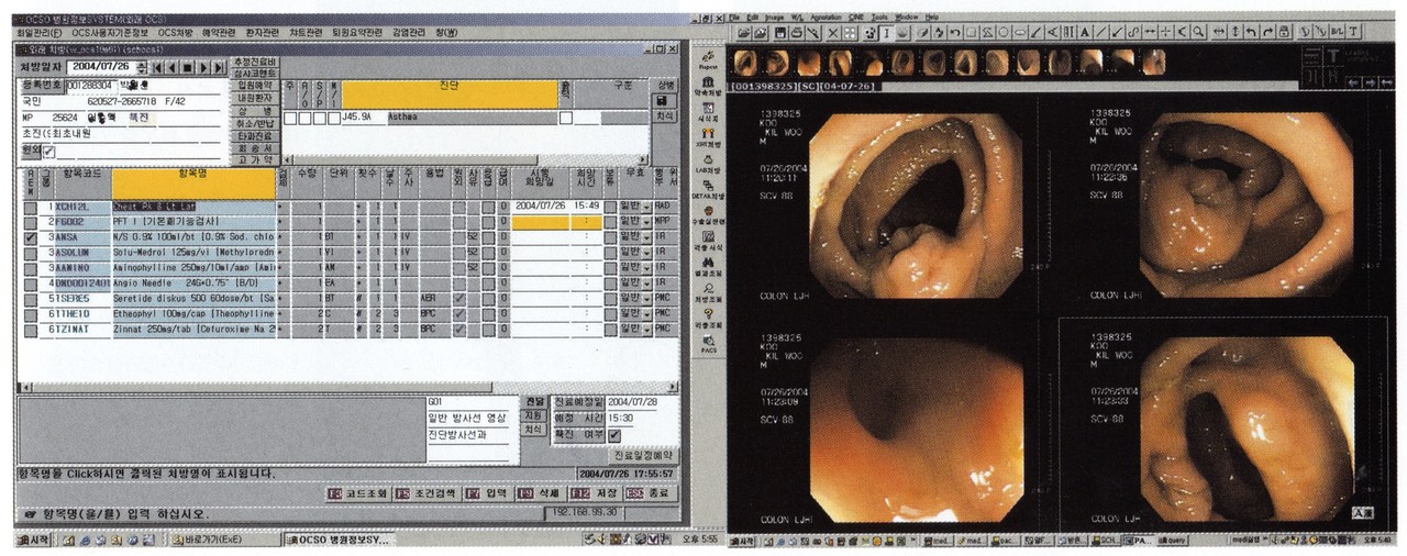 OCS(왼쪽)와 PACS(오른쪽)의 도입은 병원정보화의 중요성을 확인하는 계기가 됐다. (출처: 컴퓨터월드 2004년 8월 호)