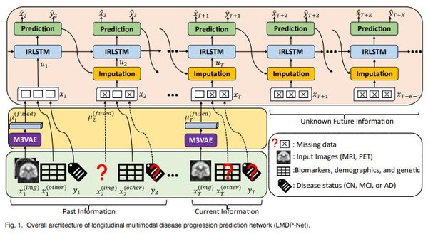 알츠하이머와 파킨슨 인공지능 모델 논문 그래픽.
