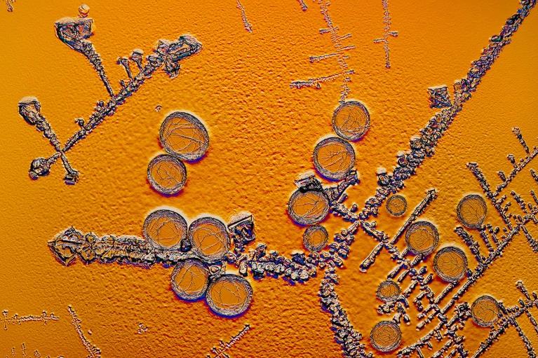 인슐린 결정. 설계된 인슐린은 혈당 수치에 반응해 작용할 수 있다. 사진=네이처 via 과학사진도서관