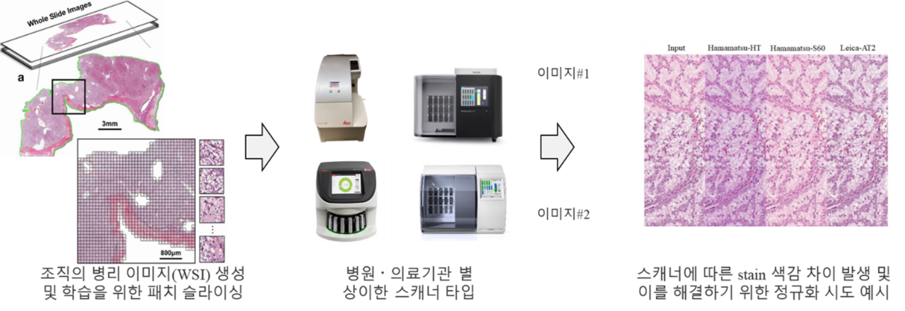 그림 4. 스캐너에 따른 병리 슬라이드 이미지의 색상 변화 문제. 우측은 스캐너의 차이 보정을 위한 정규화 과정 예시 (출처: https://doi.org/10.48550/arXiv.2204.09782)